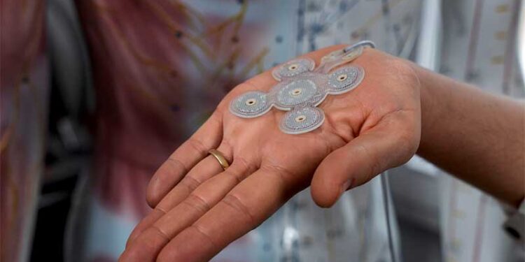 So sieht EASEE, der intelligente Taktgeber für das Gehirn, bei Epilepsie aus. Credit: Precisis GmbH