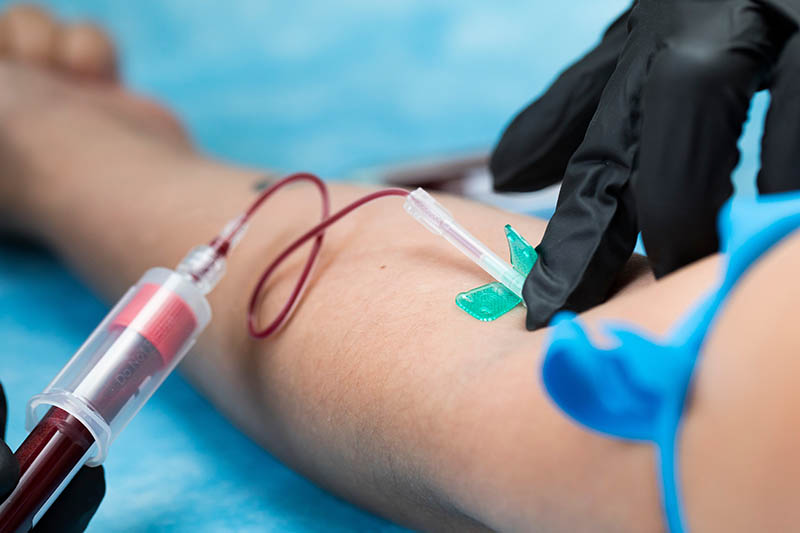 Bluttests können künftig eine wichtige Rolle in der Abklärung von Demenzerkrankungen spielen. Credit: Shutterstock